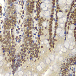 Immunohistochemistry of paraffin-embedded rat Intestine using SMARCB1 Polyclonal Antibody at dilution of 1:200 (400x lens).