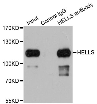 Immunoprecipitation analysis of 200 ug extracts of 293T cells using 1ug HELLS Polyclonal Antibody. Western blot was performed from the immunoprecipitate using HELLS Polyclonal Antibody at a dilution of 1:1000.
