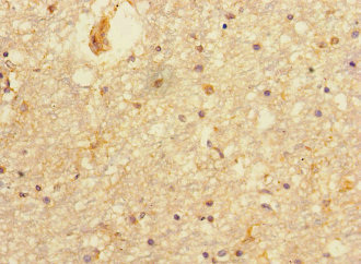 Immunohistochemistry of paraffin-embedded human brain tissue using PRMT3 Polyclonal Antibody at dilution of 1:100