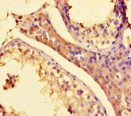 Immunohistochemistry of paraffin-embedded human testis tissue using SET1 Polyclonal Antibody at dilution of 1:100