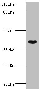 Western blot <br>All lanes: SET7 Polyclonal Antibody at 4ug/ml + MCF-7 whole cell lysate<br>Secondary<br>Goat polyclonal to rabbit at 1/10000 dilution<br>Predicted band size: 41 kDa<br>Observed band size: 41 kDa<br><br>