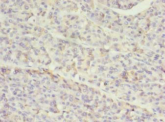 Immunohistochemistry of paraffin-embedded human pancreatic tissue usingSET7 Polyclonal Antibody at dilution of 1:100