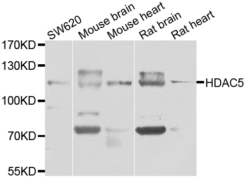 Western blot analysis of extracts of various cell lines, using HDAC5 Polyclonal Antibody.