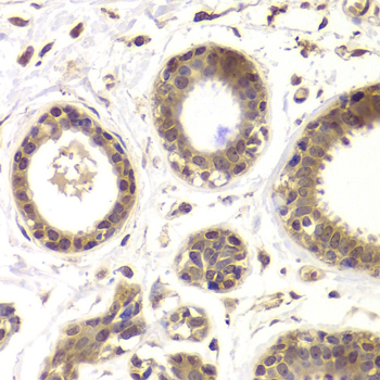 Immunohistochemistry of paraffin-embedded Human mammary gland using HDAC5 Polyclonal Antibody at dilution of 1:100 (x40 lens).