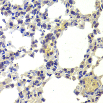 Immunohistochemistry of paraffin-embedded Mouse lung using HDAC5 Polyclonal Antibody at dilution of 1:100 (x40 lens).