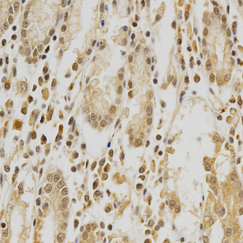 Immunohistochemistry of paraffin-embedded human stomach using HDAC6 Polyclonal Antibody at dilution of 1:100 (x40 lens).