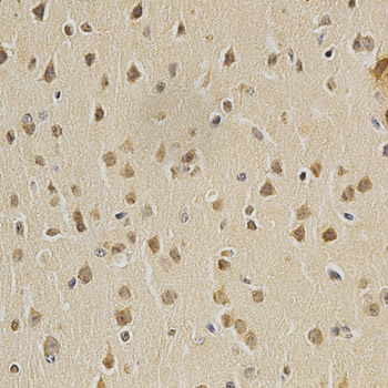 Immunohistochemistry of paraffin-embedded mouse brain using HDAC6 Polyclonal Antibody at dilution of 1:100 (x40 lens).