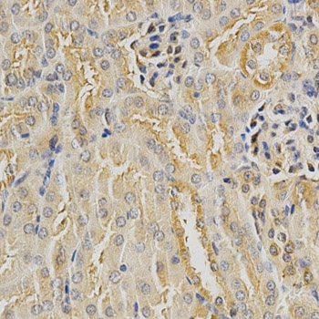 Immunohistochemistry of paraffin-embedded mouse kidney using HDAC6 Polyclonal Antibody at dilution of 1:100 (x40 lens).