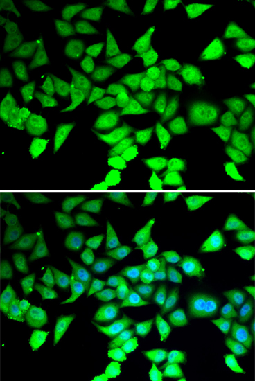 Immunofluorescence analysis of MCF7 cell using HDAC7 Polyclonal Antibody. Blue: DAPI for nuclear staining.