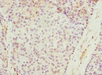 Immunohistochemistry of paraffin-embedded human pancreatic tissue using SAP30 Polyclonal Antibody at dilution of 1:100