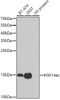 Western blot - Histone H3K14ac (Acetyl H3K14) Polyclonal Antibody