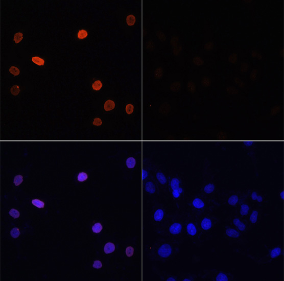 Immunofluorescence - Histone H3K14ac (Acetyl H3K14) Polyclonal Antibody
