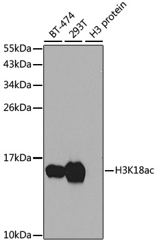 Western blot - Histone H3K18ac (Acetyl H3K18) Polyclonal Antibody