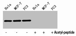Western Blot analysis of HELA MCF7 PC3 cells using Histone H4K8ac (Acetyl H4K8) Polyclonal Antibody.