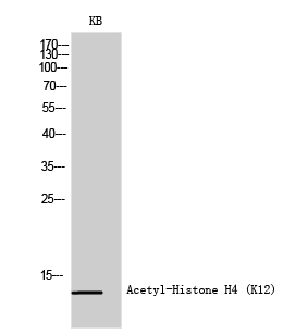 Western Blot analysis of KB cells using Histone H4K12ac (Acetyl H4K12) Polyclonal Antibody.