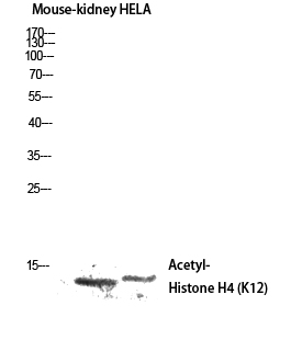 Western blot analysis of Mouse-kidney Histone H4K12ac (Acetyl H4K12) Polyclonal Antibody.