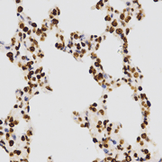 Immunohistochemistry of paraffin-embedded rat lung tissue using H3K27me2 Dimethyl Polyclonal Antibody at dilution of 1:200 (x400 lens).
