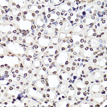 Immunohistochemistry - Histone H3K27me3 (H3K27 Trimethyl) Polyclonal Antibody