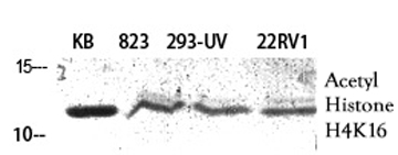Western Blot analysis of KB 823 293-UV 22RV1 cells using Histone H4K16ac (Acetyl H4K16) Polyclonal Antibody