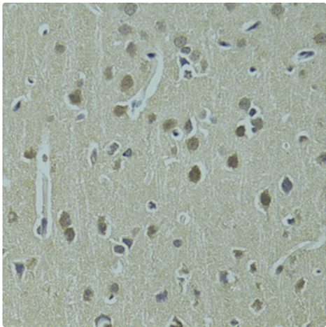 Immunohistochemistry of paraffin embedded rat brain using UBE2I Polyclonal Antibody at dilution of 1:100 (40x lens).