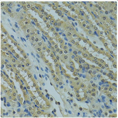 Immunohistochemistry of paraffin embedded mouse kidney using UBE2I Polyclonal Antibody at dilution of 1:100 (40x lens).