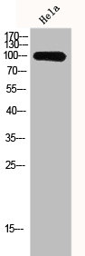GCN5 Polyclonal Antibody (100 µl)