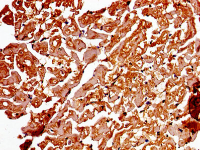 ADAMTS4 Polyclonal Antibody (100 µl)