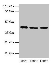 ATXN3 Polyclonal Antibody (50 µl)
