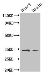 CDK5 Polyclonal Antibody (100 µl)
