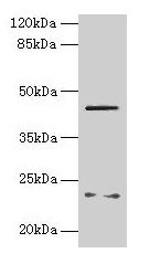 FIBP Polyclonal Antibody (100 µl)