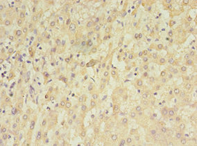 TET3 Polyclonal Antibody (50 µl)