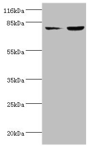 ACSL4 Polyclonal Antibody (100 µl)