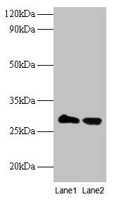 TPMT Polyclonal Antibody (100 µl)