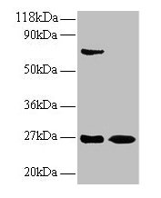 IFNG Polyclonal Antibody (100 µl)
