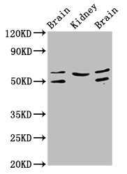 ANGPT2 Polyclonal Antibody (100 µl)