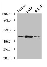 HLA-C Polyclonal Antibody (100 µl)