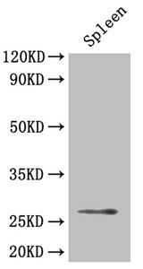 BDNF Polyclonal Antibody (100 µl)