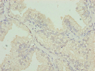 CS Polyclonal Antibody (100 µl)