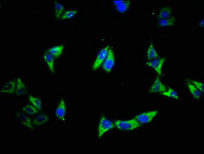 EGFR Polyclonal Antibody (20 µl)