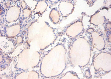 ADAM15 Polyclonal Antibody (20 µl)