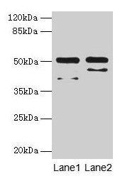 CRHR1 Polyclonal Antibody (100 µl)