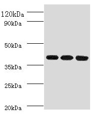 FCGRT Polyclonal Antibody (100 µl)