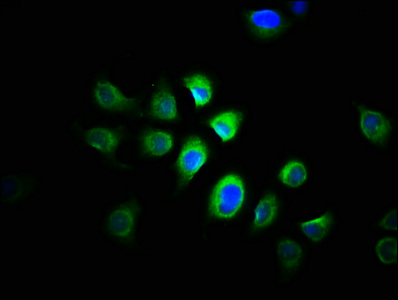 PRMT1 Polyclonal Antibody (50 µl)