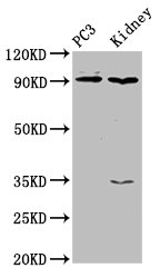 CDK11A Polyclonal Antibody (100 µl)