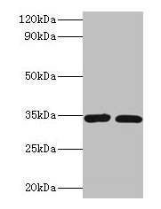 CASP7 Polyclonal Antibody (100 µl)