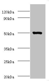 ACTL7A Polyclonal Antibody (100 µl)