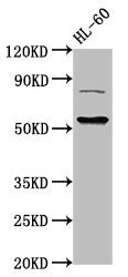 Histone Acetyltransferase KAT5 Polyclonal Antibody (100 µl)
