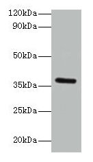 BRCC3 Polyclonal Antibody (100 µl)