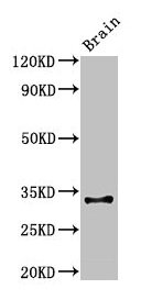 Cd74 Polyclonal Antibody (100 µl)