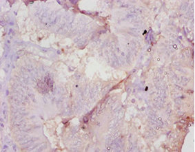 Amh Polyclonal Antibody (100 µl)